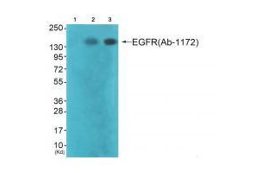 Western blot - EGFR (Ab-1172) Antibody from Signalway Antibody (33189) - Antibodies.com