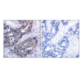 Immunohistochemistry - IRS-1 (Ab-312) Antibody from Signalway Antibody (33191) - Antibodies.com