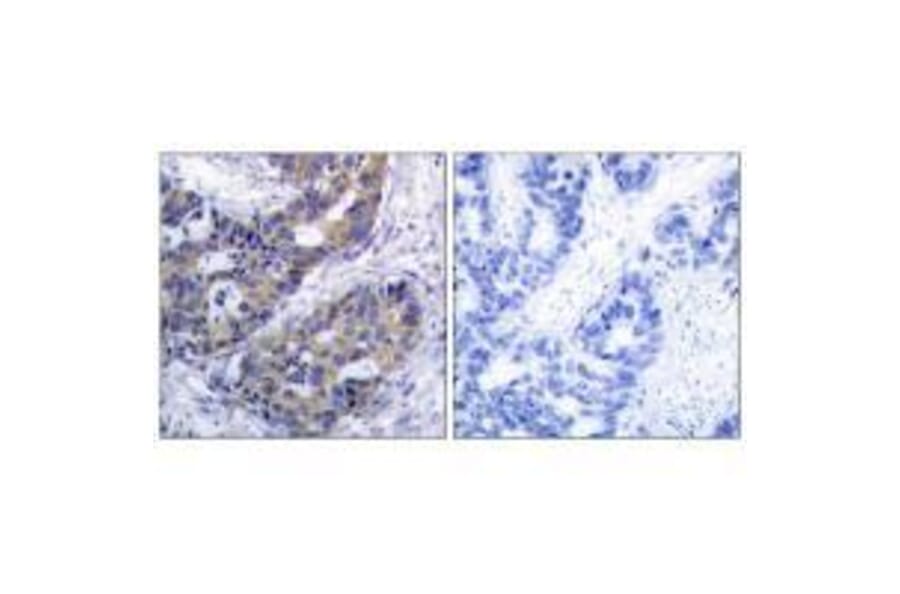 Immunohistochemistry - IRS-1 (Ab-312) Antibody from Signalway Antibody (33191) - Antibodies.com