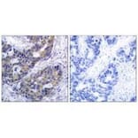 Immunohistochemistry - IRS-1 (Ab-312) Antibody from Signalway Antibody (33191) - Antibodies.com