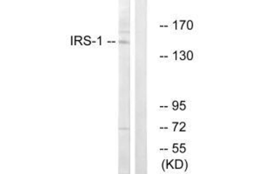 Western blot - IRS-1 (Ab-312) Antibody from Signalway Antibody (33191) - Antibodies.com