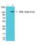 Western blot - IRS-1 (Ab-312) Antibody from Signalway Antibody (33191) - Antibodies.com