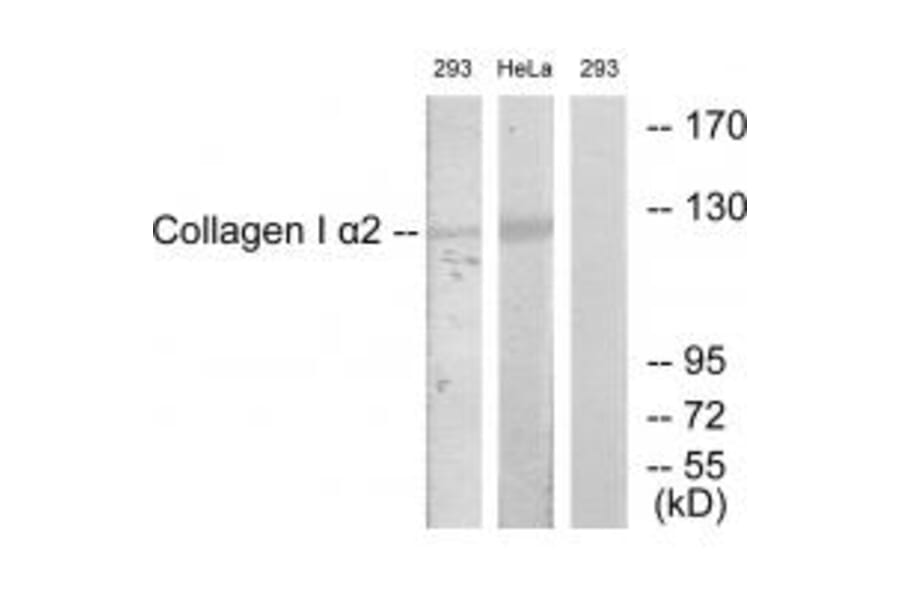 Western blot - Collagen I α2 Antibody from Signalway Antibody (34203) - Antibodies.com