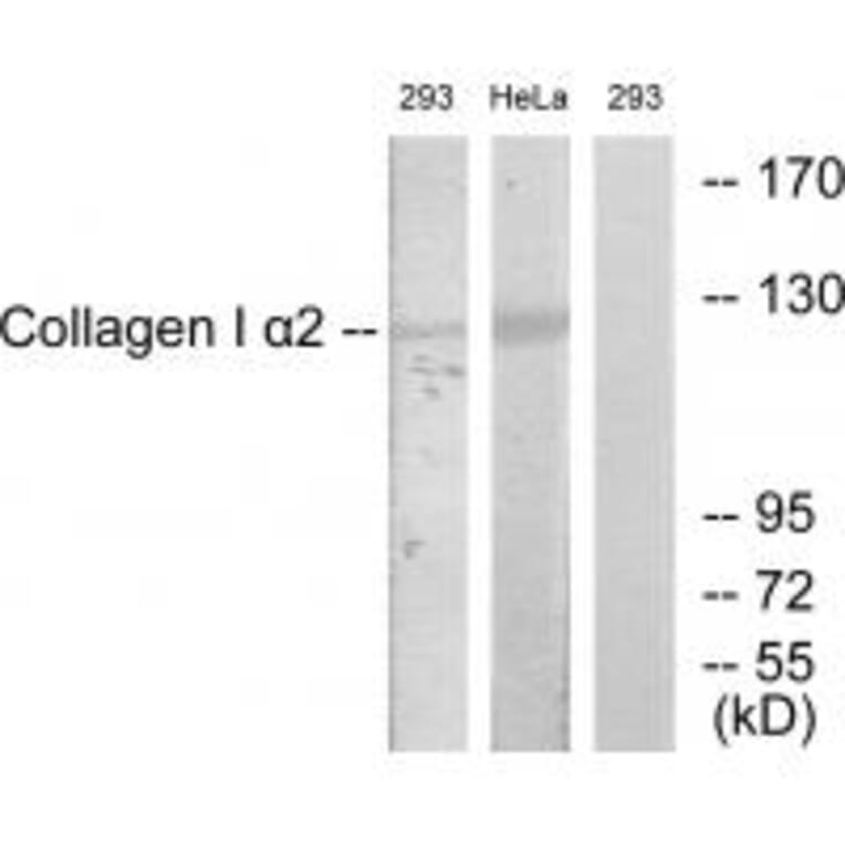 Western blot - Collagen I α2 Antibody from Signalway Antibody (34203) - Antibodies.com