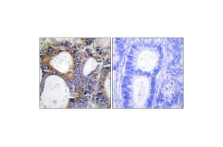 Immunohistochemistry - Collagen I α2 Antibody from Signalway Antibody (34203) - Antibodies.com