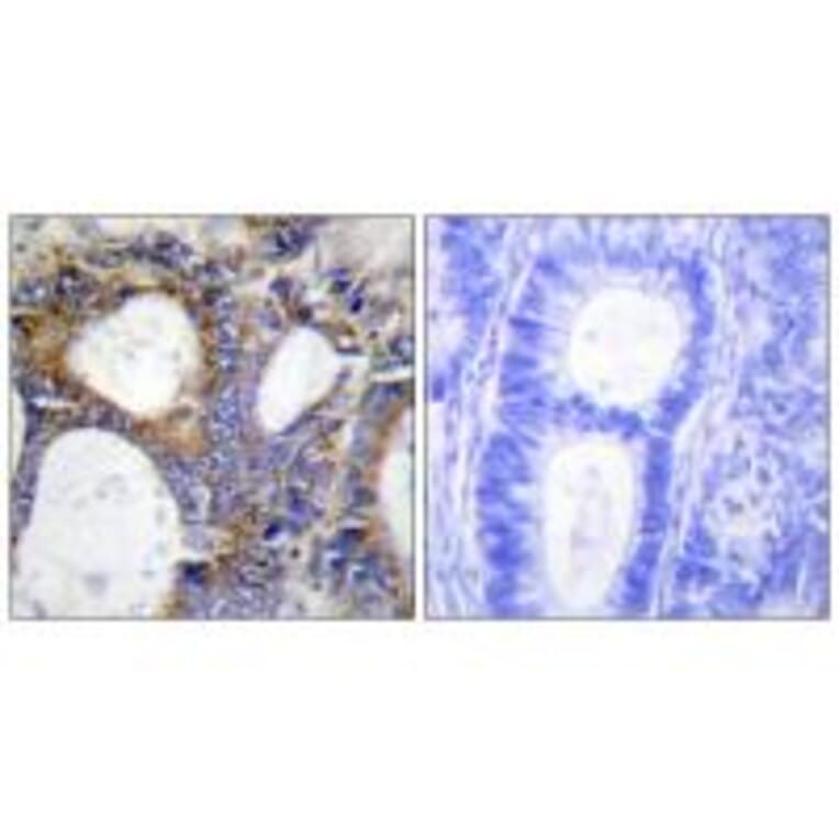 Immunohistochemistry - Collagen I α2 Antibody from Signalway Antibody (34203) - Antibodies.com