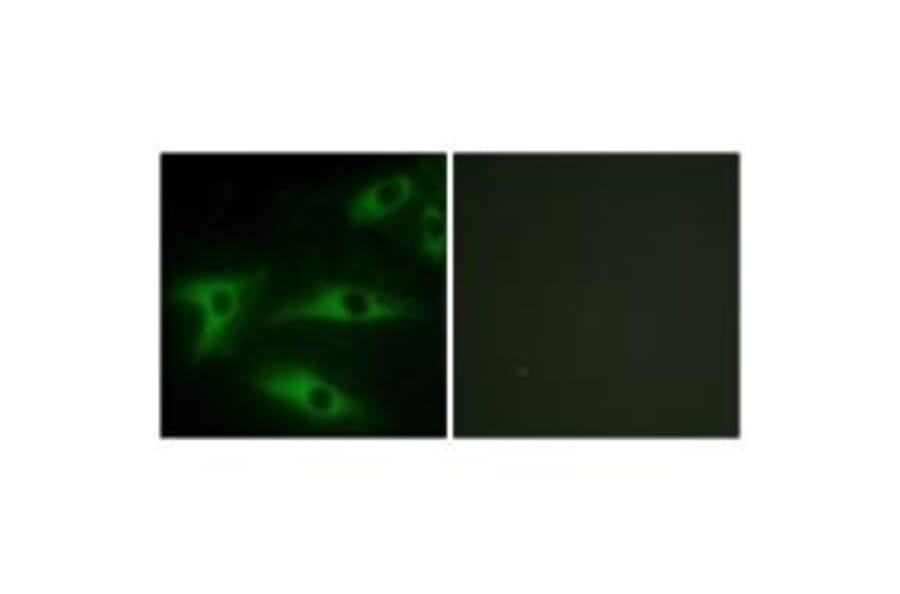 Immunofluorescence - Collagen I α2 Antibody from Signalway Antibody (34203) - Antibodies.com
