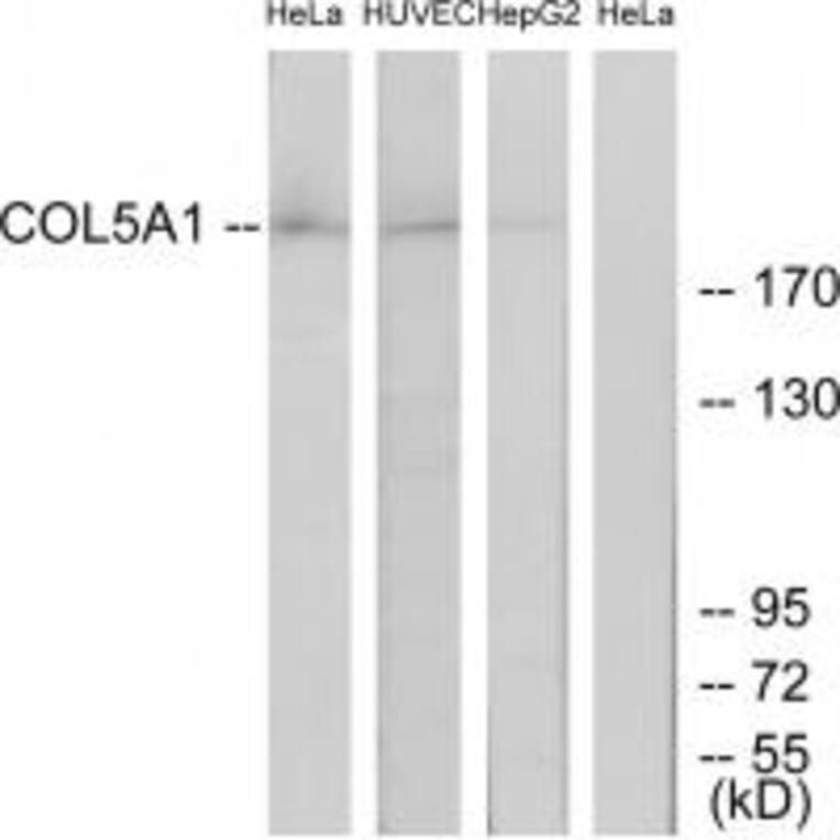 Western blot - Collagen V α1 Antibody from Signalway Antibody (34205) - Antibodies.com