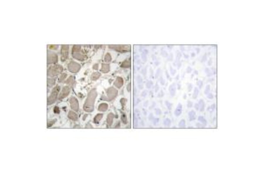 Immunohistochemistry - Collagen V α1 Antibody from Signalway Antibody (34205) - Antibodies.com