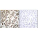 Immunohistochemistry - Collagen V α1 Antibody from Signalway Antibody (34205) - Antibodies.com