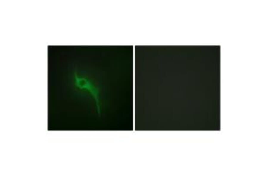 Immunofluorescence - Collagen V α1 Antibody from Signalway Antibody (34205) - Antibodies.com