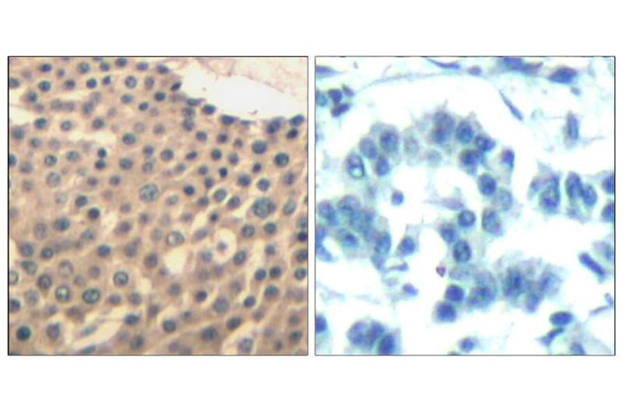 Immunohistochemistry - HDAC4/HDAC5/HDAC9 (Ab-246/259/220) Antibody from Signalway Antibody (21517) - Antibodies.com