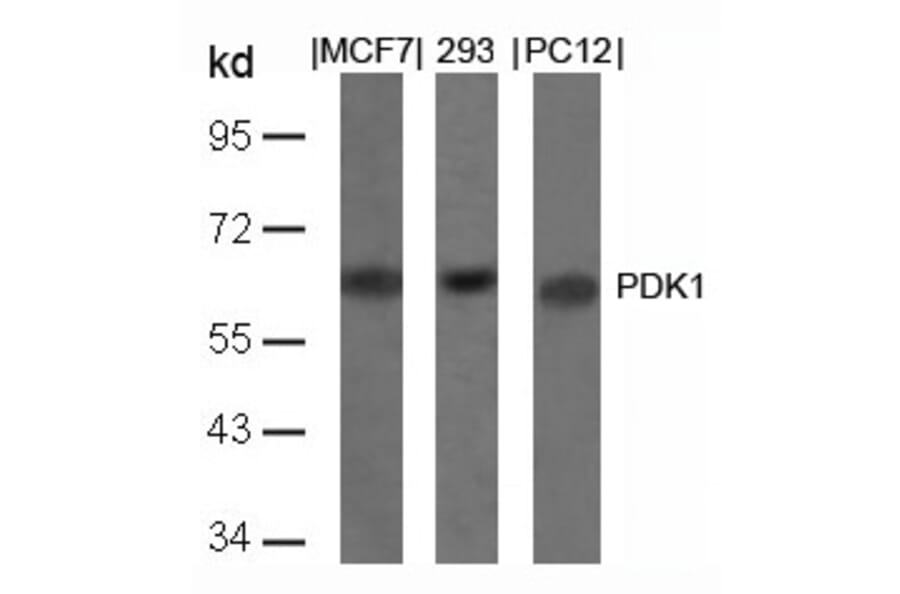 Western blot - PDK1 (Ab-241) Antibody from Signalway Antibody (21005) - Antibodies.com