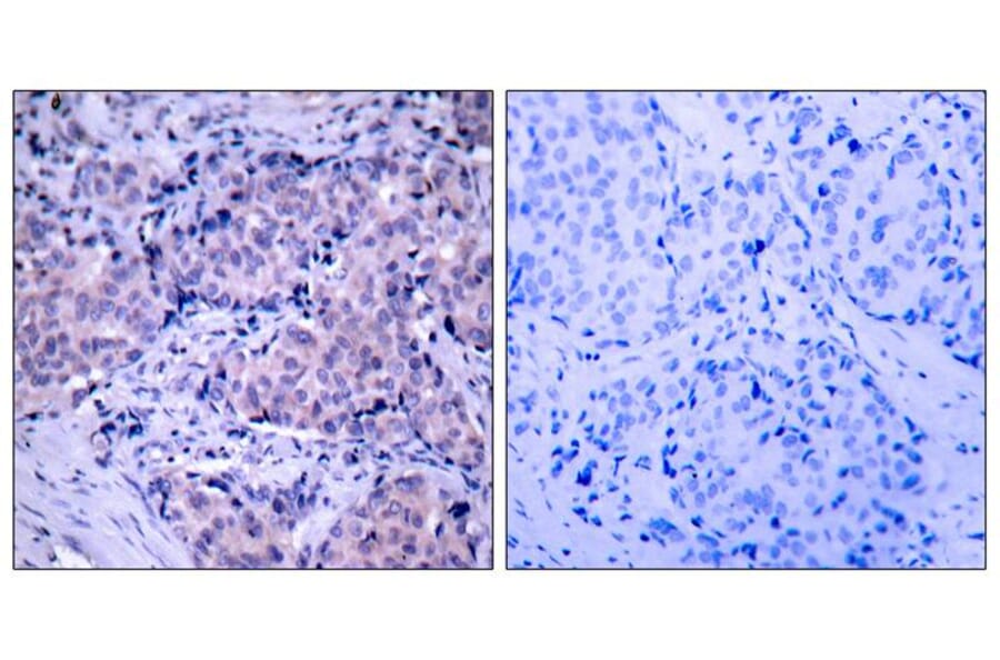 Immunohistochemistry - PDK1 (Ab-241) Antibody from Signalway Antibody (21005) - Antibodies.com