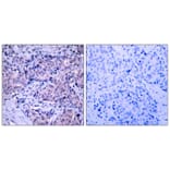 Immunohistochemistry - PDK1 (Ab-241) Antibody from Signalway Antibody (21005) - Antibodies.com