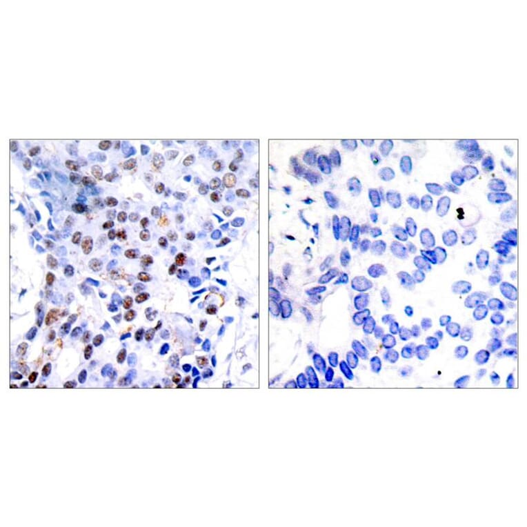 Immunohistochemistry - c-Jun (Ab-91) Antibody from Signalway Antibody (21021) - Antibodies.com