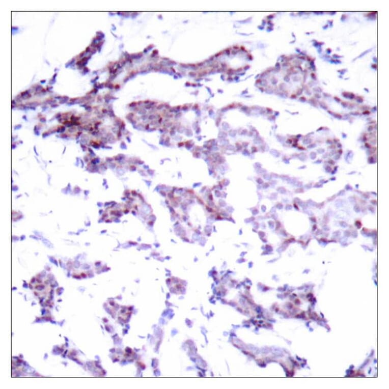 Immunohistochemistry - Elk1 (Ab-389) Antibody from Signalway Antibody (21037) - Antibodies.com