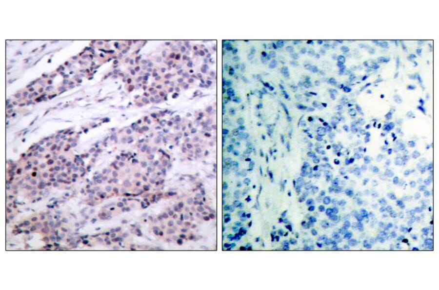 Immunohistochemistry - BCL-2 (Ab-56) Antibody from Signalway Antibody (21059) - Antibodies.com