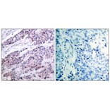 Immunohistochemistry - BCL-2 (Ab-56) Antibody from Signalway Antibody (21059) - Antibodies.com
