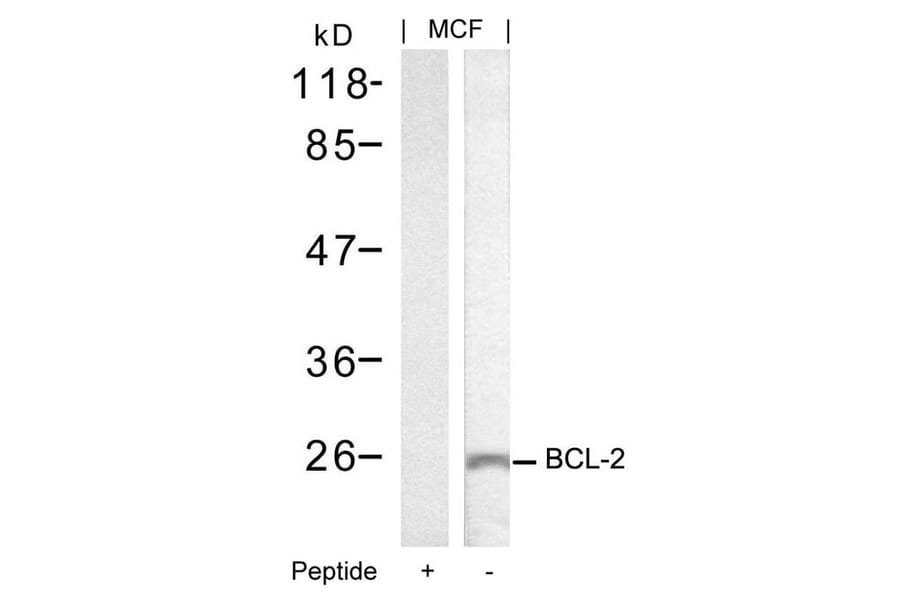 Western blot - BCL-2 (Ab-70) Antibody from Signalway Antibody (21060) - Antibodies.com