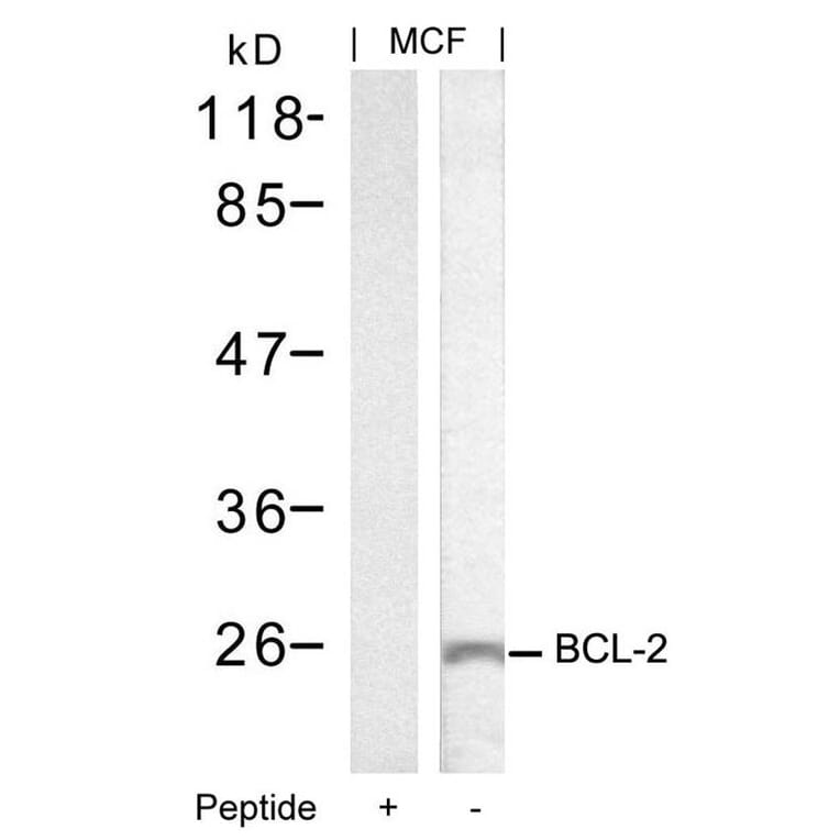 Western blot - BCL-2 (Ab-70) Antibody from Signalway Antibody (21060) - Antibodies.com