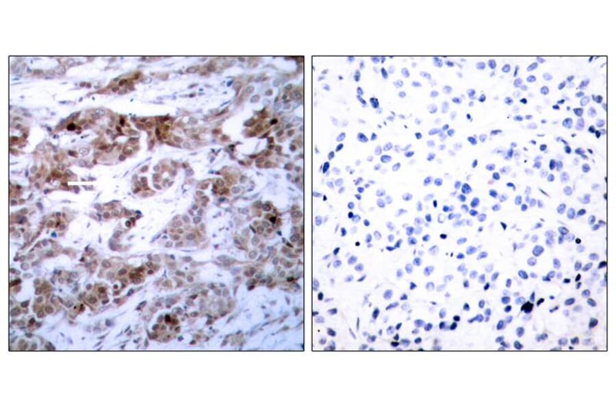 Immunohistochemistry - BCL-2 (Ab-70) Antibody from Signalway Antibody (21060) - Antibodies.com