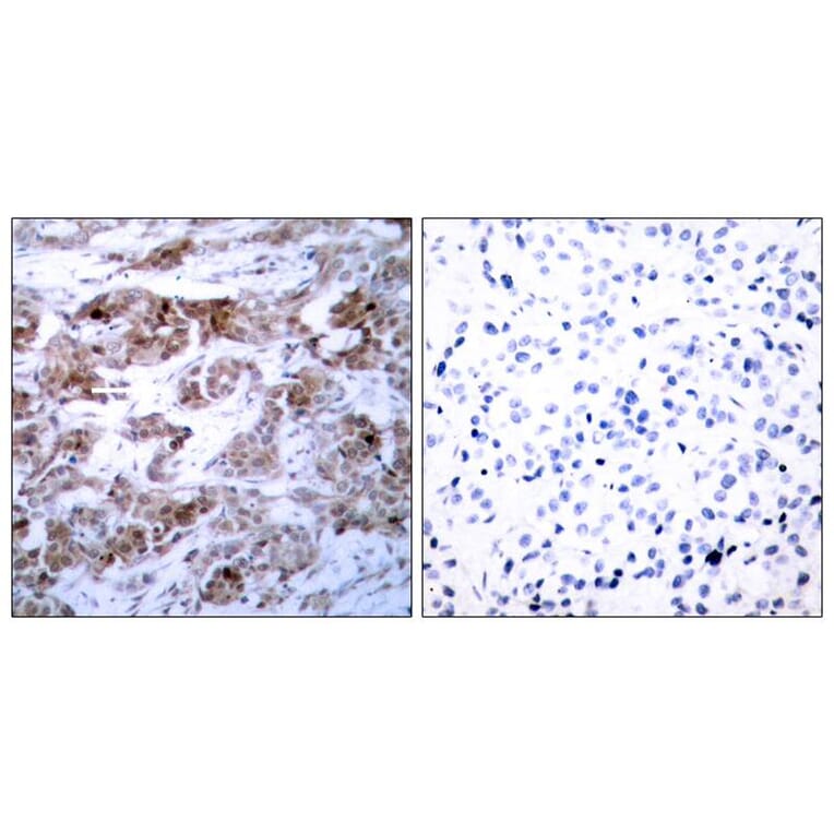 Immunohistochemistry - BCL-2 (Ab-70) Antibody from Signalway Antibody (21060) - Antibodies.com