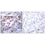 Immunohistochemistry - BCL-2 (Ab-70) Antibody from Signalway Antibody (21060) - Antibodies.com