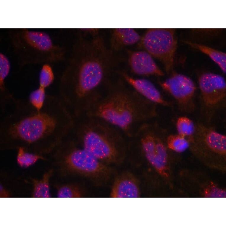 Immunofluorescence - BCL-2 (Ab-70) Antibody from Signalway Antibody (21060) - Antibodies.com