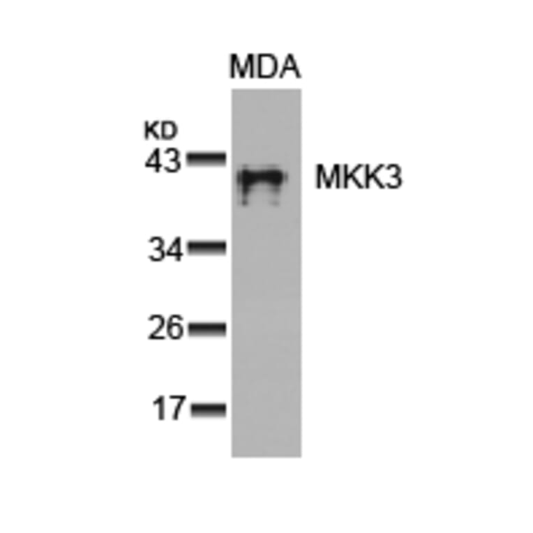 Western blot - MKK3 (Ab-189) Antibody from Signalway Antibody (21116) - Antibodies.com