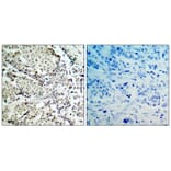Immunohistochemistry - MKK3 (Ab-189) Antibody from Signalway Antibody (21116) - Antibodies.com