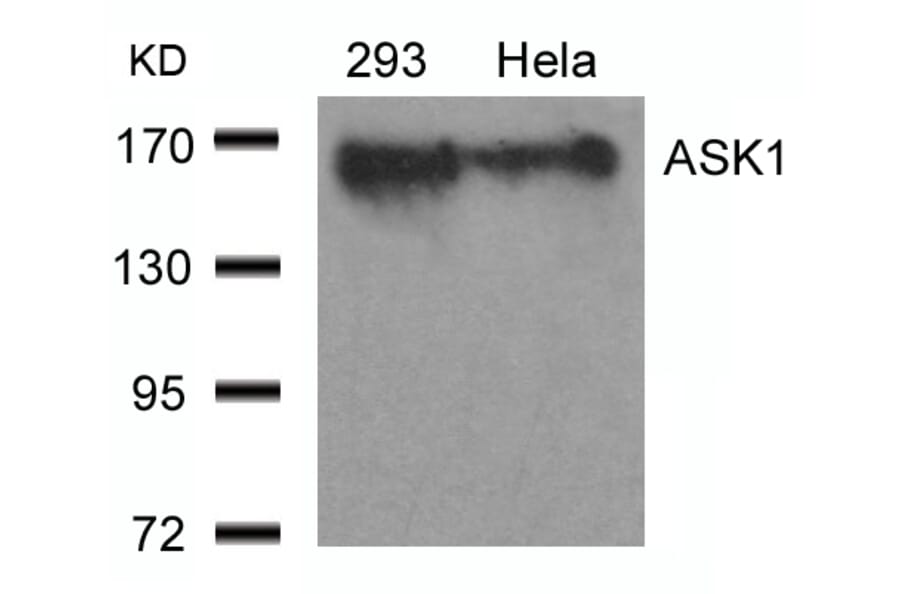 Western blot - ASK1 (Ab-966) Antibody from Signalway Antibody (21134) - Antibodies.com