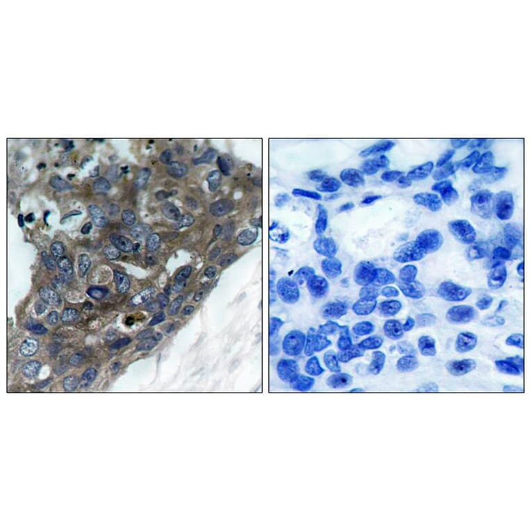 Immunohistochemistry - ASK1 (Ab-966) Antibody from Signalway Antibody (21134) - Antibodies.com