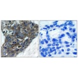 Immunohistochemistry - ASK1 (Ab-966) Antibody from Signalway Antibody (21134) - Antibodies.com