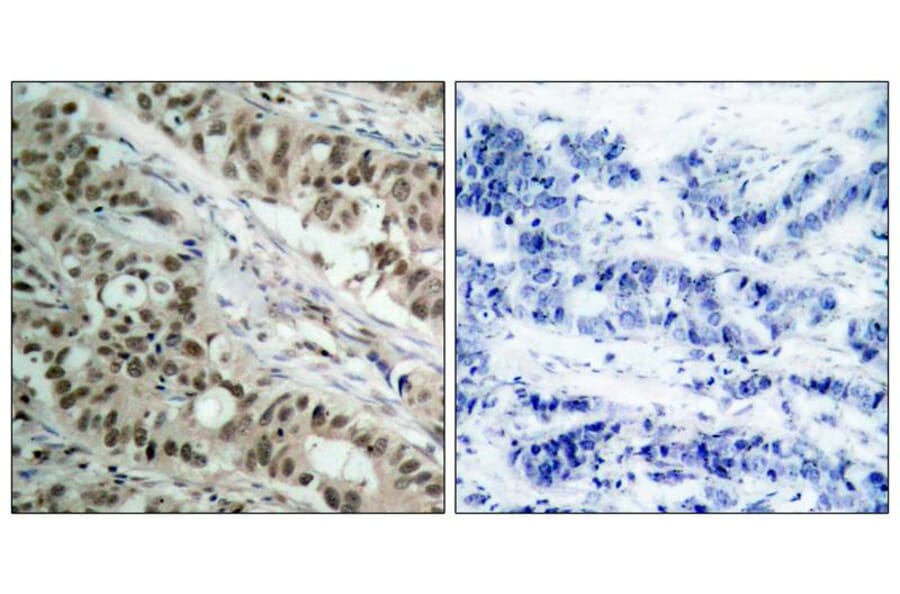 Immunohistochemistry - FKHR (Ab-256) Antibody from Signalway Antibody (21138) - Antibodies.com