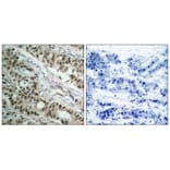 Immunohistochemistry - FKHR (Ab-256) Antibody from Signalway Antibody (21138) - Antibodies.com