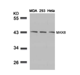 Western blot - MKK6 (Ab-207) Antibody from Signalway Antibody (21153) - Antibodies.com