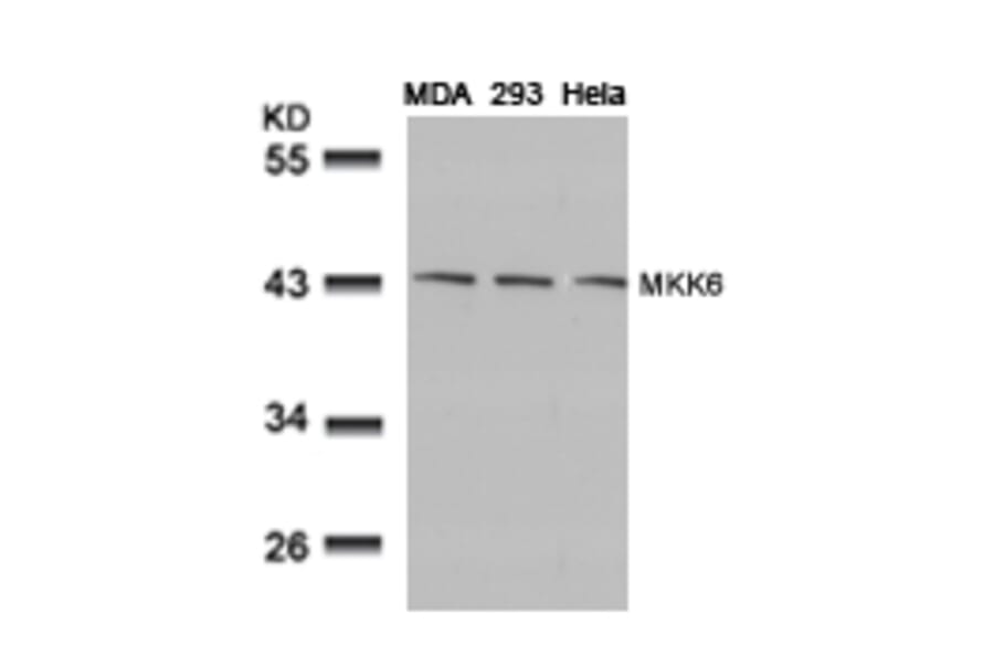Western blot - MKK6 (Ab-207) Antibody from Signalway Antibody (21153) - Antibodies.com