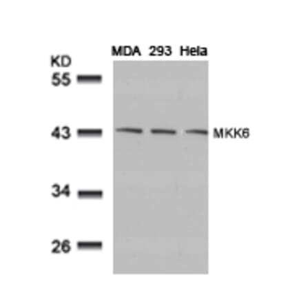 Western blot - MKK6 (Ab-207) Antibody from Signalway Antibody (21153) - Antibodies.com