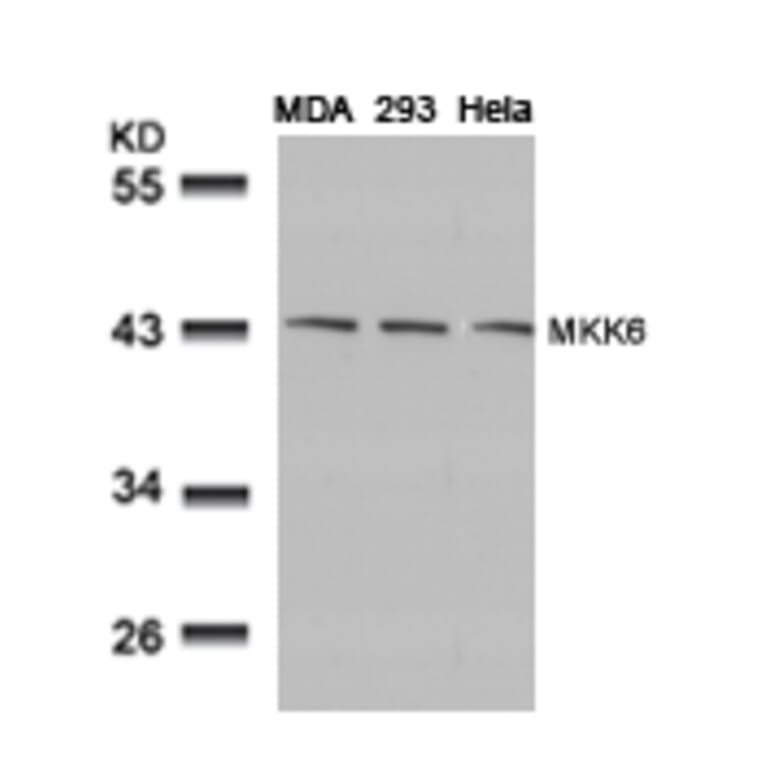 Western blot - MKK6 (Ab-207) Antibody from Signalway Antibody (21153) - Antibodies.com