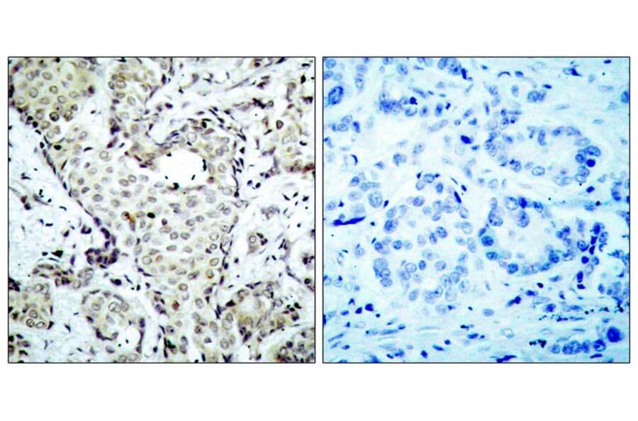 Immunohistochemistry - MKK6 (Ab-207) Antibody from Signalway Antibody (21153) - Antibodies.com