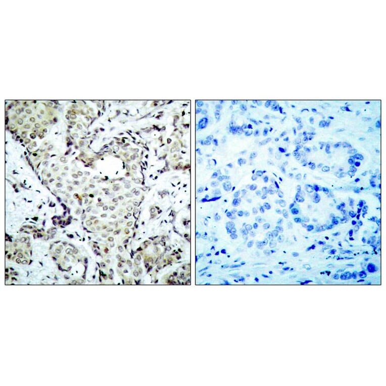 Immunohistochemistry - MKK6 (Ab-207) Antibody from Signalway Antibody (21153) - Antibodies.com
