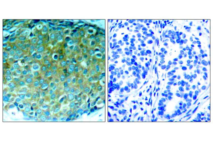 Immunohistochemistry - PAK1 (Ab-212) Antibody from Signalway Antibody (21160) - Antibodies.com