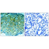Immunohistochemistry - PAK1 (Ab-212) Antibody from Signalway Antibody (21160) - Antibodies.com