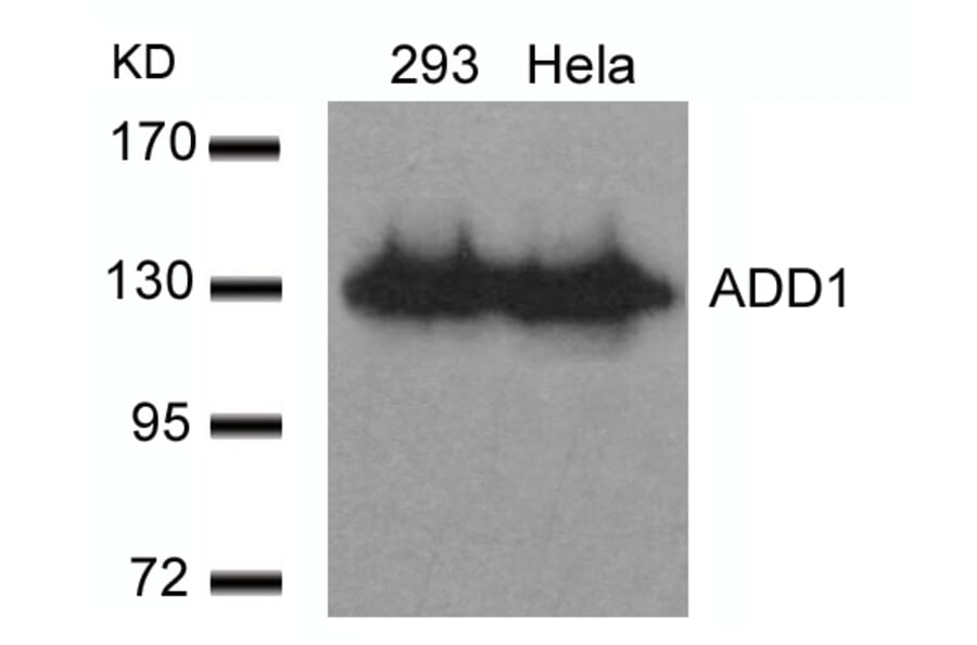 Western blot - ADD1 (Ab-726) Antibody from Signalway Antibody (21189) - Antibodies.com