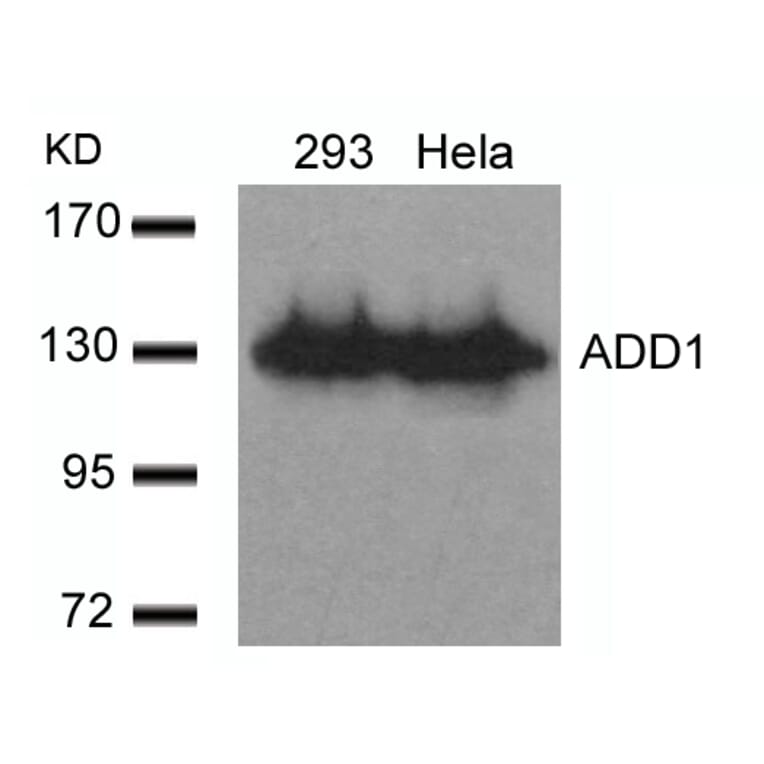 Western blot - ADD1 (Ab-726) Antibody from Signalway Antibody (21189) - Antibodies.com