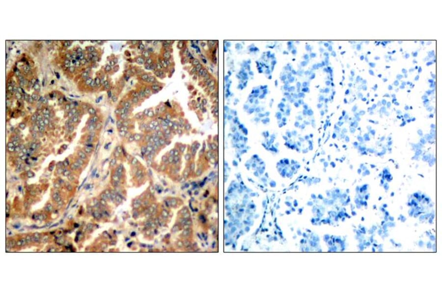 Immunohistochemistry - ADD1 (Ab-726) Antibody from Signalway Antibody (21189) - Antibodies.com