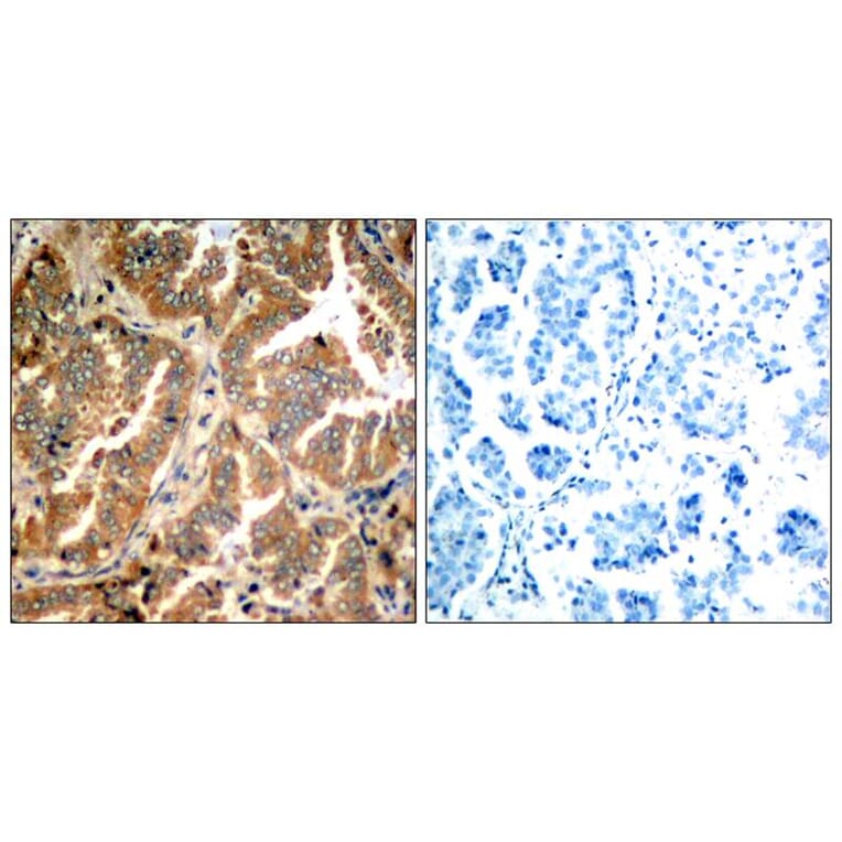 Immunohistochemistry - ADD1 (Ab-726) Antibody from Signalway Antibody (21189) - Antibodies.com