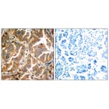 Immunohistochemistry - ADD1 (Ab-726) Antibody from Signalway Antibody (21189) - Antibodies.com