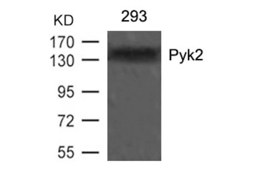 Western blot - Pyk2 (Ab-402) Antibody from Signalway Antibody (21209) - Antibodies.com